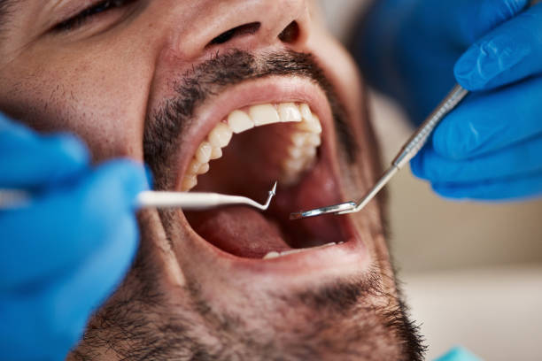 Best Urgent Dental Care for Toothaches in Verdigris, OK