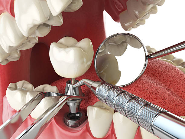 Best Emergency Wisdom Tooth Extraction in Verdigris, OK